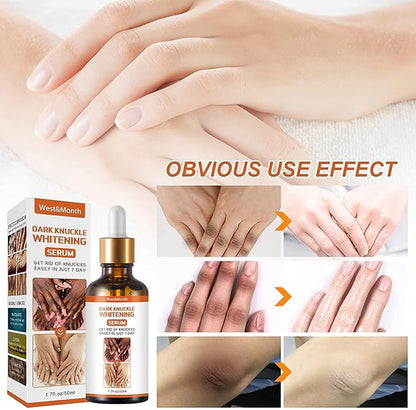 Dark Knuckles Whitening Serum