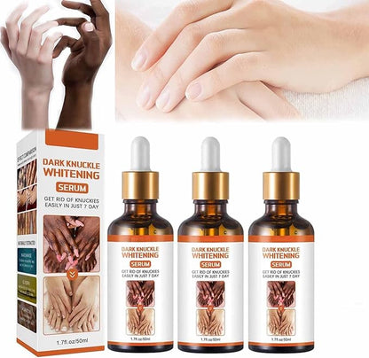 Dark Knuckles Whitening Serum