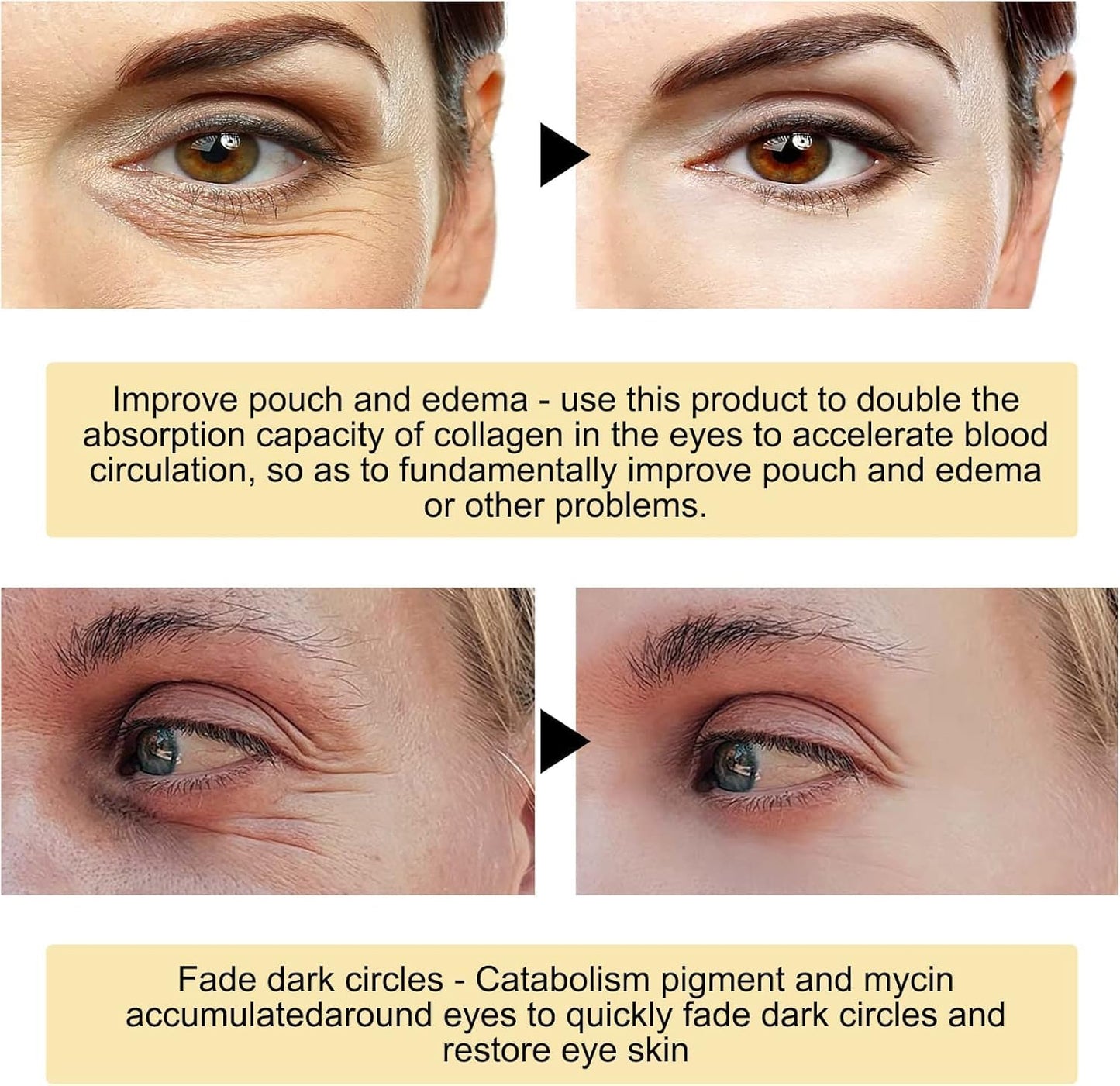 Luxurious 24k Gold Eye Treatment Mask - Collagen & Hyaluronic Acid Enriched, Reduces Dark Circles, Puffiness, and Wrinkles, Provides Long-Lasting Moisturizing Effect, Enhances Eye Area Glow